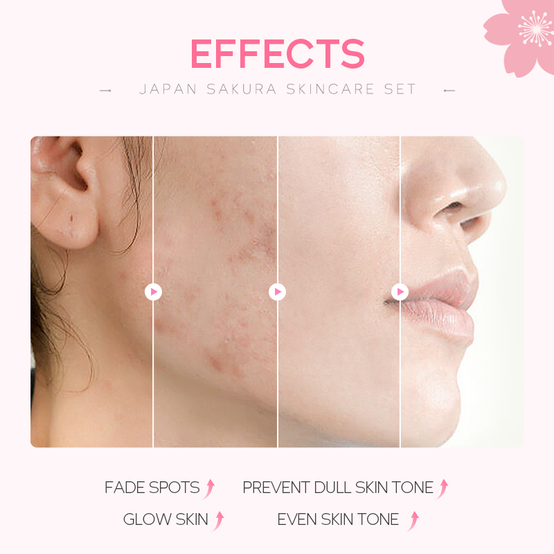 Conjunto de cuidados com a pele LAIKOU Sakura 4 peças, antienvelhecimento, hidratante, aumenta o brilho com gel · foto 2