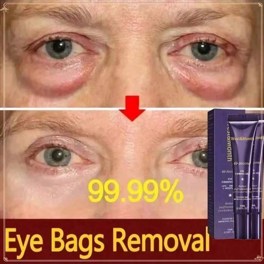 Gel Firmador para Olhos 10ml – Levanta Olheiras, Suaviza Olheiras e Linhas Finas | Hidrata, Ilumina, Cuida das Bolsas