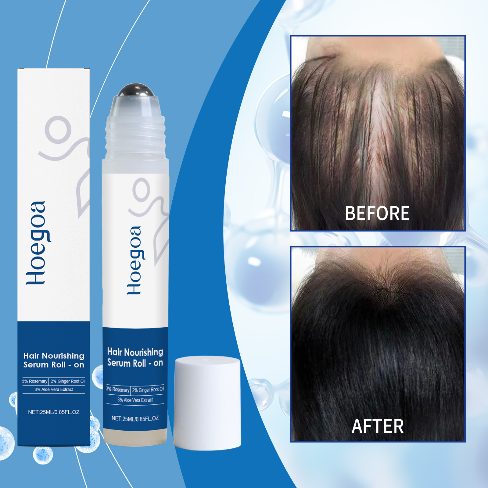 Sérum para Crescimento de Cabelo de Alecrim Roll On, Sérum Capilar Roll-On, Sérum para Couro Cabeludo Bloqueador