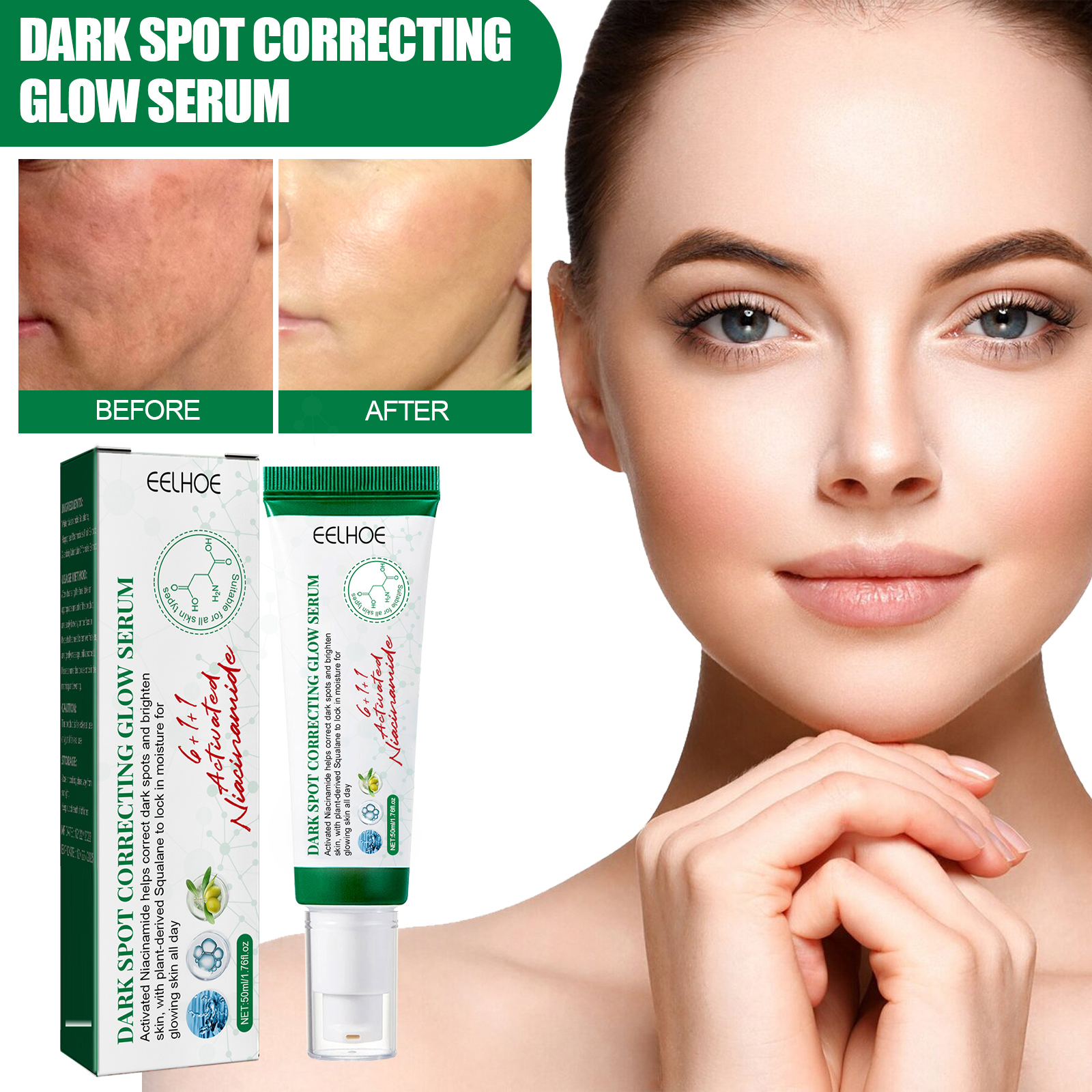 Eelhoe Soro Corretivo de Manchas Escuras para o Rosto, Ilumina Manchas, Hidrata, Ilumina, Nutre a Pele Facial,