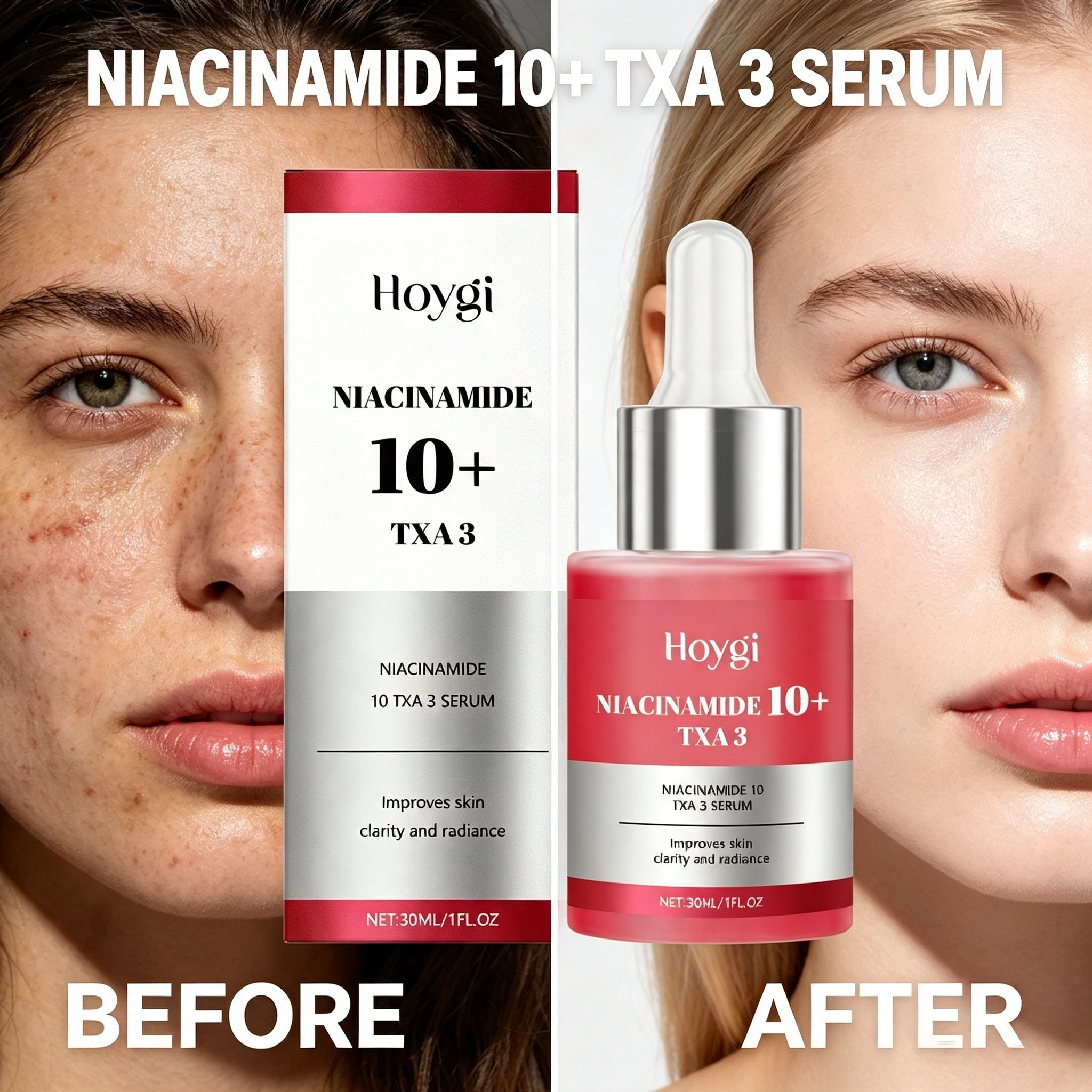 Soro Hoygi Niacinamida TXA3 , Essência Iluminadora , Facial Desbotado Para Manchas Escuras Hidratante Cuidados Com A Pel