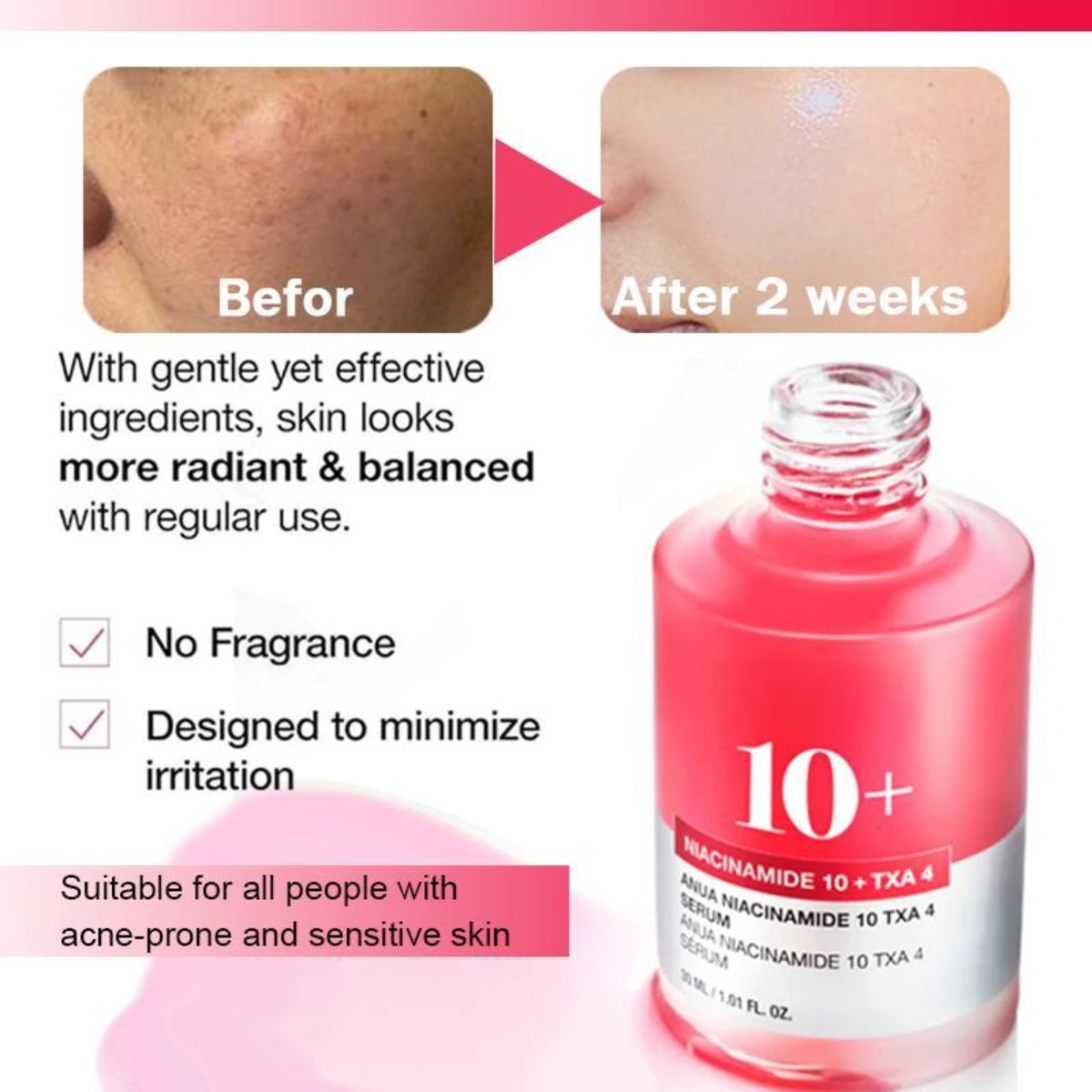 Niacinamida 10 % + TXA 4 Soro De Hiperpigmentação Hidratante