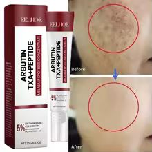 Creme Sérum Para Remoção De Manchas 15g - Ilumina O Tom Da Pele E Nutre a Pele